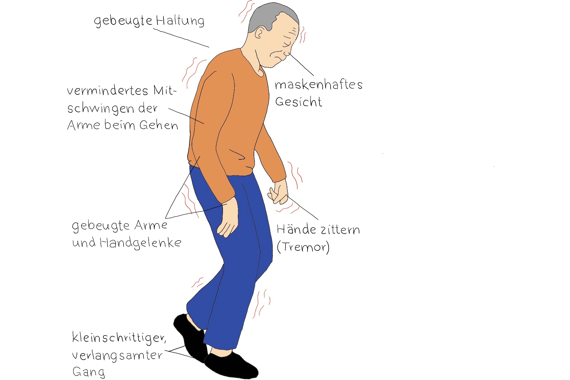 ParkinsonSyndrom Physiotherapie & Osteopathie Beger Leipzig